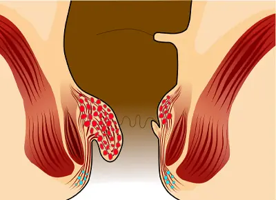 Anatomy illustration